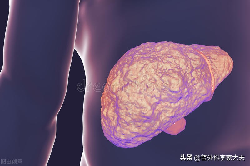 网友弟弟16岁查出肝硬化，医生有失职吗？