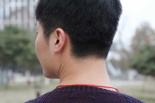 脖子上长出一粒粒小肉是怎么回事,脖子上长出了奇怪的小疙瘩怎么办