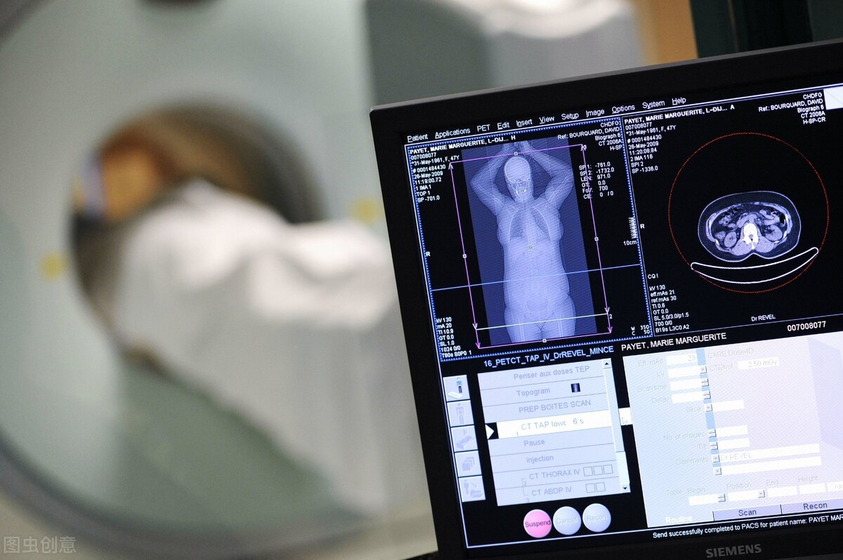 大脑罕见病都有哪些,涨姿势了十个你不知道的生活常识