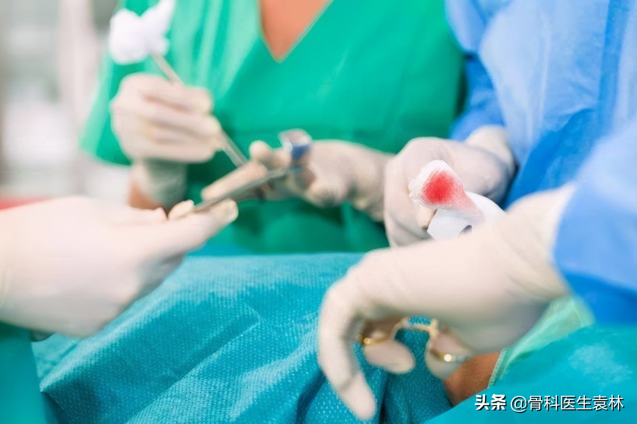 治疗骨关节炎最好的办法是什么,骨关节炎的保守治疗是什么