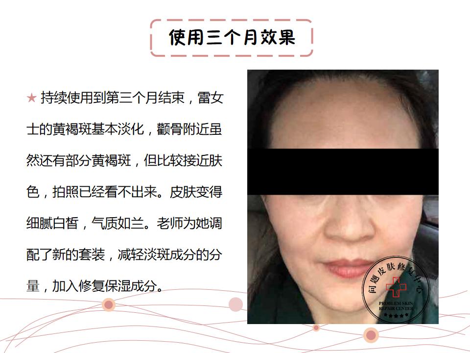 激光反黑怎么快速修复,点阵激光反黑了怎么修复