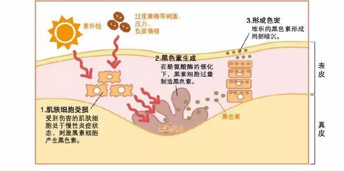 北京看痘痘好的皮肤科医院,去皮肤科看痘痘好不好