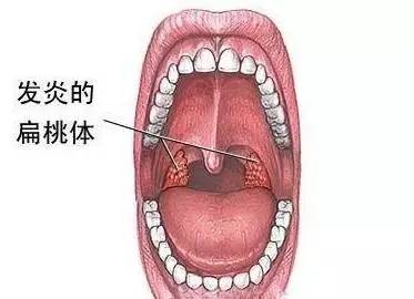今天发现尿是红色的是怎么回事,这几天尿有点红是怎么回事啊