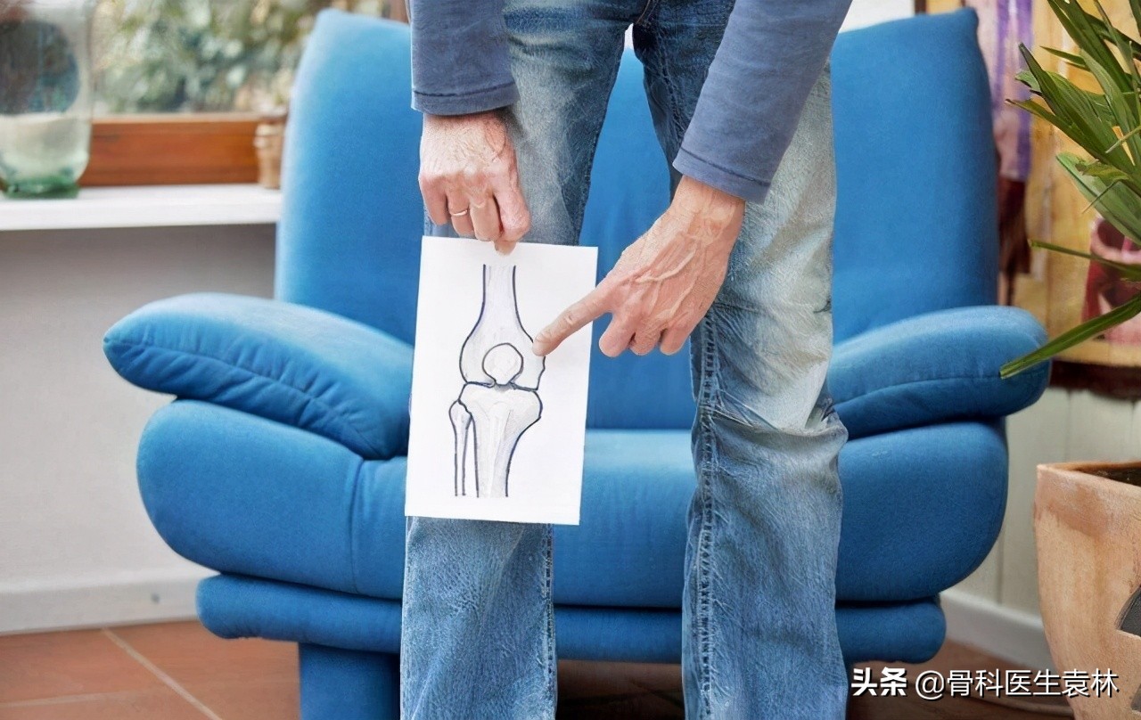 治疗骨关节炎最好的办法是什么,骨关节炎的保守治疗是什么
